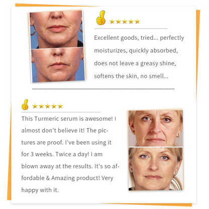 Anti-Aging & Wrinkles Moisturizing Serum