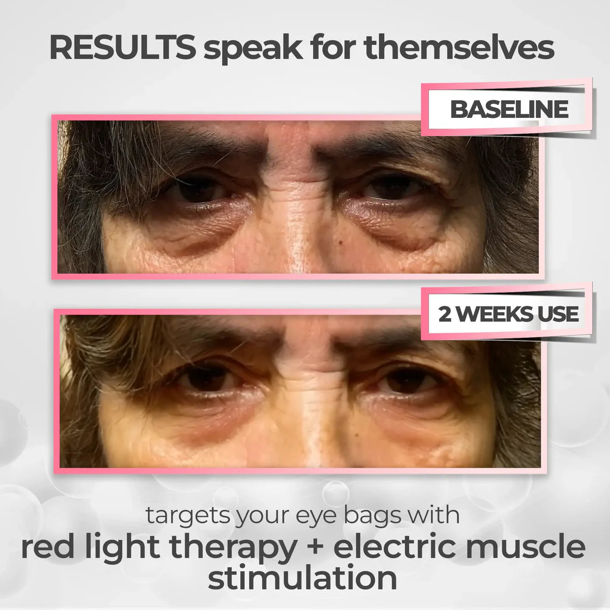 LiftEyes™ Pro